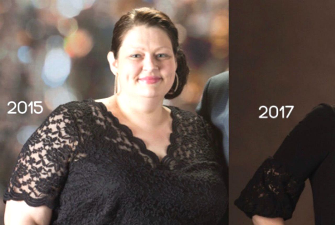 woman lost more than 150 pounds